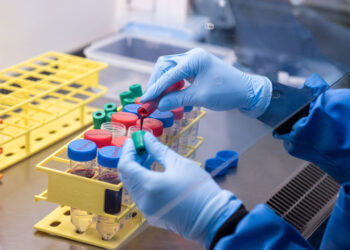 Riesgo de contagiarse de coronavirus por tocar superficies contaminadas es «bajo»