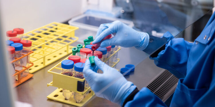 Riesgo de contagiarse de coronavirus por tocar superficies contaminadas es «bajo»