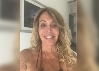 Pata Villanueva reaparece tras el accidente que sufrió en Punta del Este