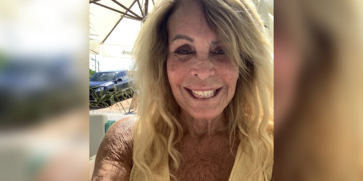 Pata Villanueva recibió el alta tras la caída que sufrió en Punta del Este