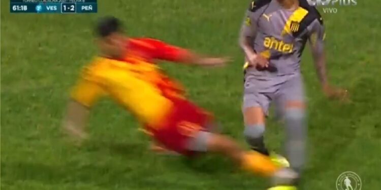 Peñarol sigue líder, pero preocupado por un patadón