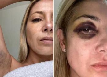 Difundieron fotos de Fabiola Yáñez golpeada y chats reveladores