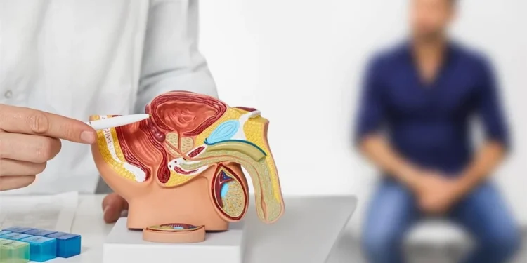 Cáncer de próstata: alertan que en las etapas iniciales no da ningún síntoma
