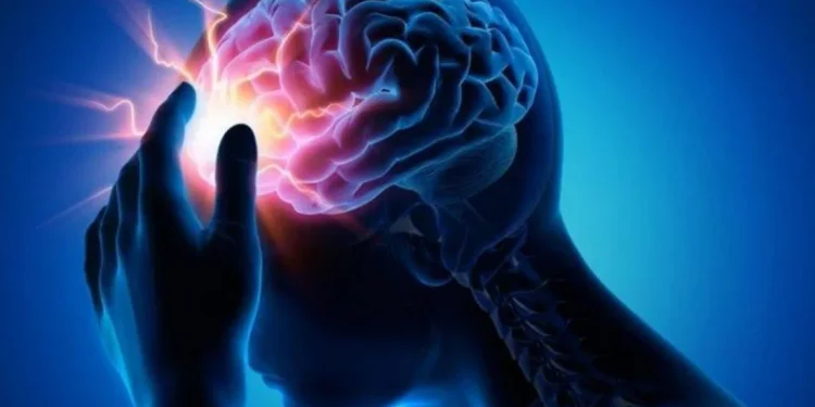 F.A.S.T: la metodología para reconocer los primeros signos de un ACV