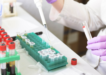 COVID-19: ¿Qué se sabe de la nueva variante XFG conocida como Frankestein?