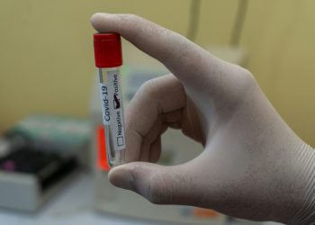 Confirman circulación de las variantes Frankenstein y Nimbus en nuestro país