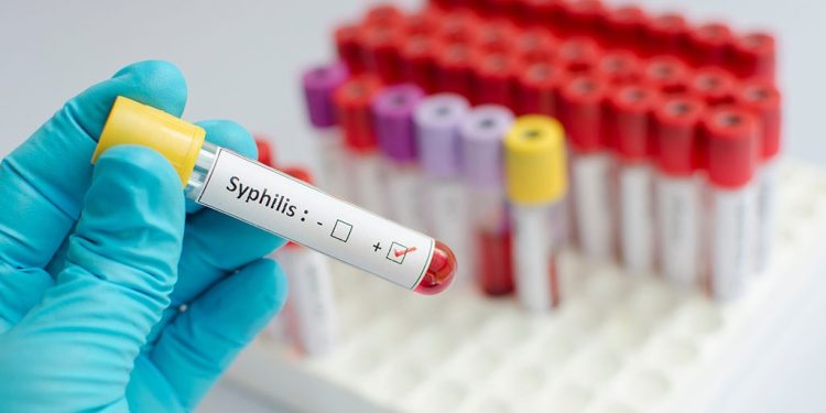 Maldonado en alerta: MSP advierte altas tasas de VIH y sífilis congénita en el departamento