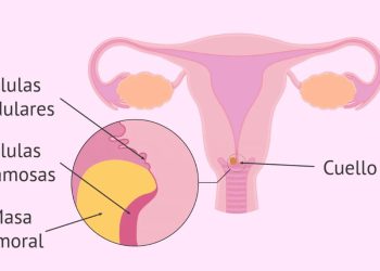En el mes de la prevención, charla sobre cáncer de cuello uterino apoyada por la dirección de salud