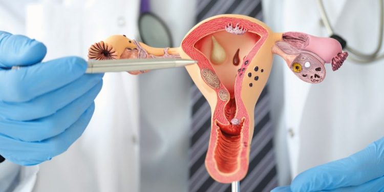 Uruguay reconoce la endometriosis como problema de salud pública y avanza en su abordaje integral