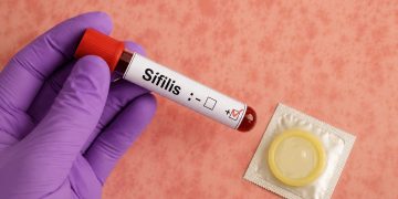 Salud refuerza estrategia contra la sífilis en Maldonado ante aumento de casos