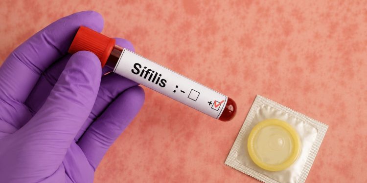Salud refuerza estrategia contra la sífilis en Maldonado ante aumento de casos